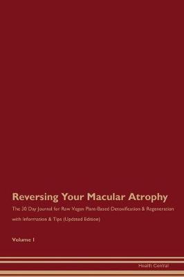 Book cover for Reversing Your Macular Atrophy