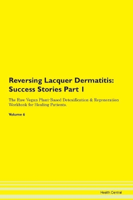 Book cover for Reversing Lacquer Dermatitis