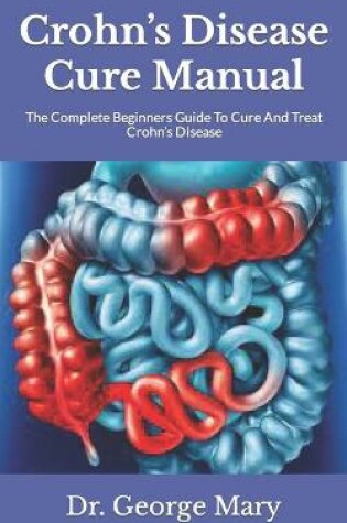 Cover of Crohn's Disease Cure Manual