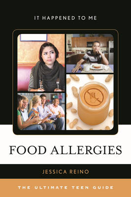 Book cover for Food Allergies