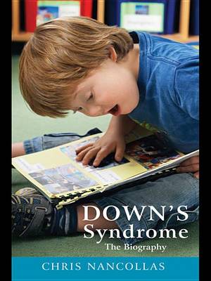 Book cover for Down's Syndrome - The Biography