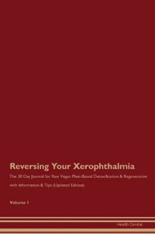 Cover of Reversing Your Xerophthalmia