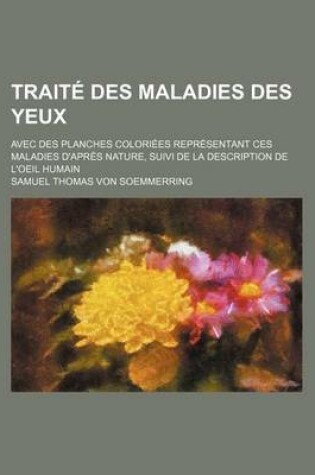 Cover of Traite Des Maladies Des Yeux (4); Avec Des Planches Coloriees Representant Ces Maladies D'Apres Nature, Suivi de La Description de L'Oeil Humain