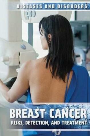 Cover of Breast Cancer