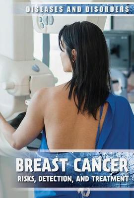 Book cover for Breast Cancer