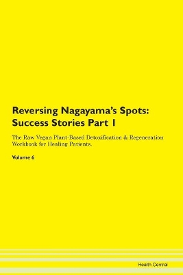 Book cover for Reversing Nagayama's Spots