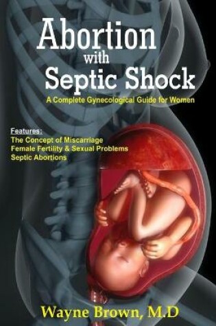 Cover of Abortion with Septic Shock