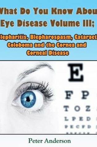 Cover of What Do You Know About Eye Disease Volume III: Blepharitis, Blepharospasm, Cataract, Coloboma and the Cornea and Corneal Disease