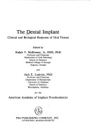 Book cover for Dental Implant