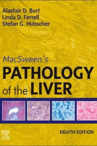 Cover of Macsween's Pathology of the Liver, E-Book