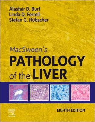 Cover of Macsween's Pathology of the Liver, E-Book