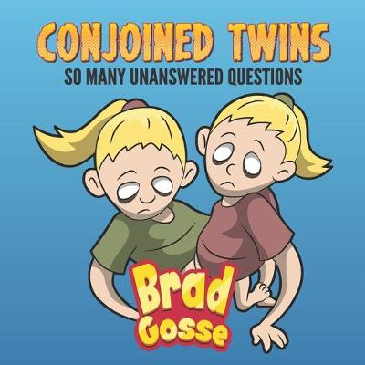 Book cover for Conjoined Twins