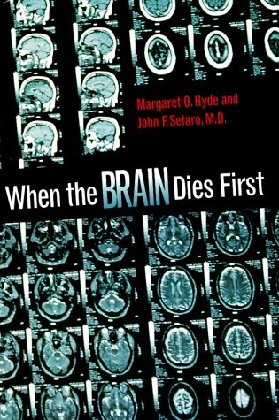 Cover of When the Brain Dies First