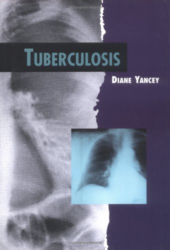 Book cover for Tuberculosis