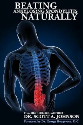 Cover of Beating Ankylosing Spondylitis Naturally