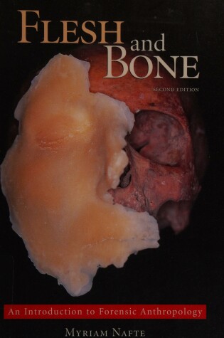 Cover of Flesh and Bone