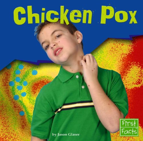 Book cover for Chicken Pox