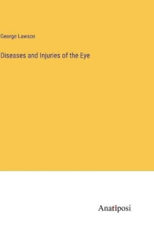 Cover of Diseases and Injuries of the Eye