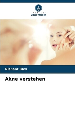 Cover of Akne verstehen