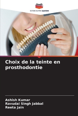 Book cover for Choix de la teinte en prosthodontie