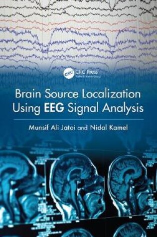 Cover of Brain Source Localization Using EEG Signal Analysis