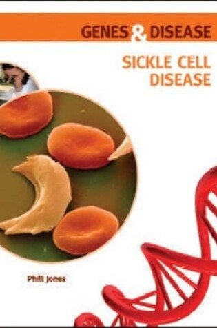 Cover of Sickle Cell Disease