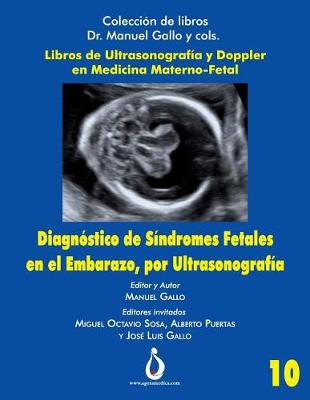 Cover of Diagnostico de S ndromes Fetales En El Embarazo, Por Ultrasonografia