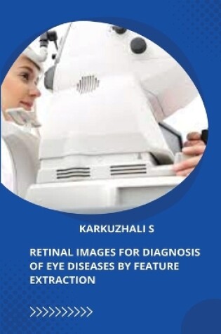 Cover of Retinal Images for Diagnosis of Eye Diseases by Feature Extraction