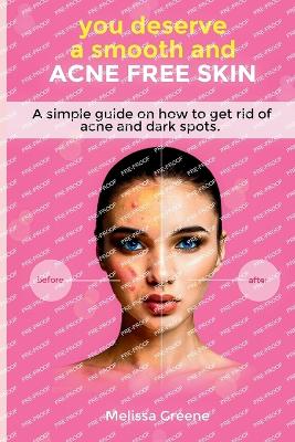 Book cover for you deserve a smooth and acne free skin