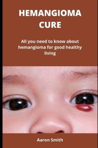 Cover of Hemangioma Cure