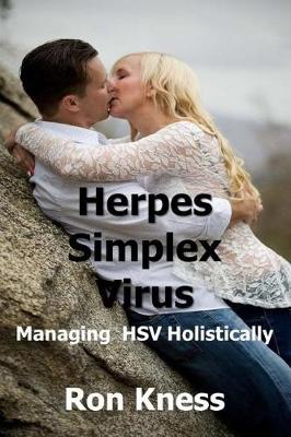 Book cover for Herpes Simplex Virus