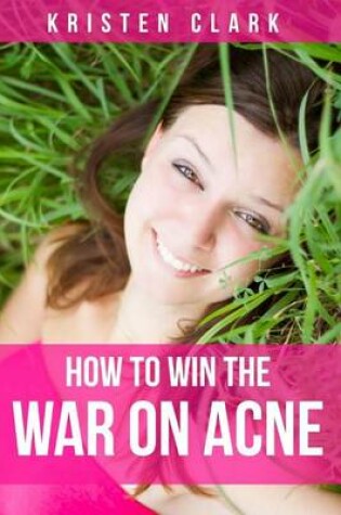 Cover of How to Win the War on Acne