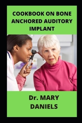 Cover of Cookbook On Bone Anchored Auditory Implant