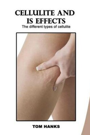 Cover of Cellulite and Is Effects