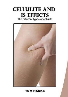 Book cover for Cellulite and Is Effects