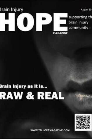 Cover of Brain Injury Hope Magazine - August 2019