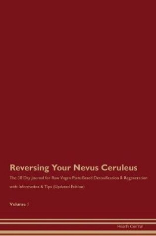 Cover of Reversing Your Nevus Ceruleus