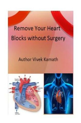 Cover of Remove Your Heart Blocks Without Surgery