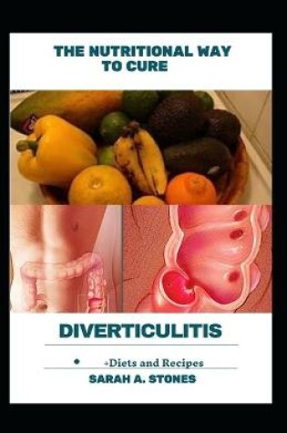 Cover of The Nutritional Way To Cure Diverticulitis