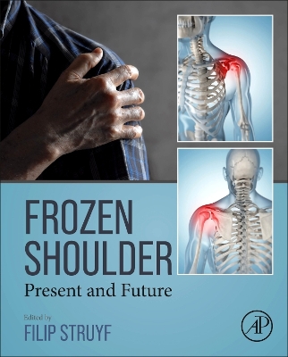 Cover of Frozen Shoulder