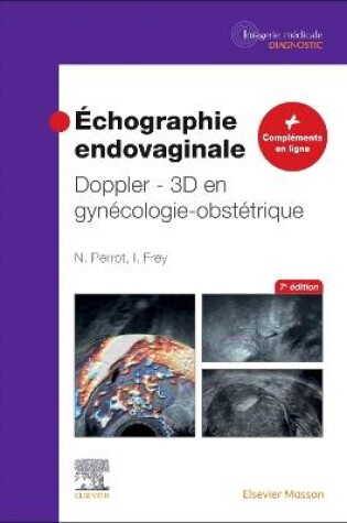 Cover of Échographie Endovaginale Doppler - 3D