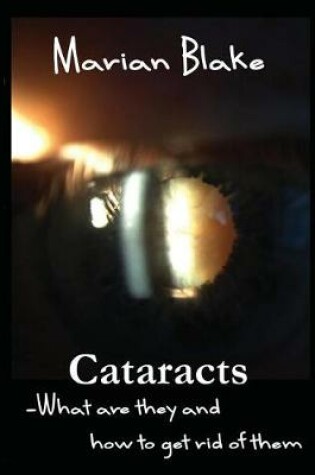 Cover of Cataracts