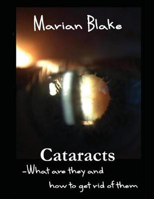 Book cover for Cataracts