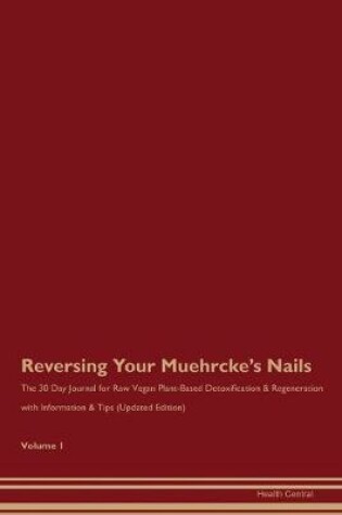 Cover of Reversing Your Muehrcke's Nails