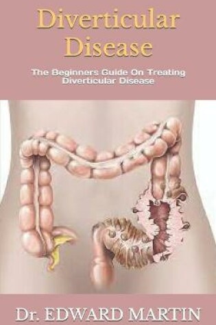 Cover of Diverticular Disease