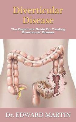 Book cover for Diverticular Disease