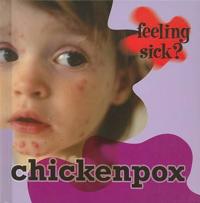 Book cover for Chickenpox