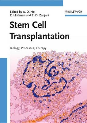 Cover of Stem Cell Transplantation