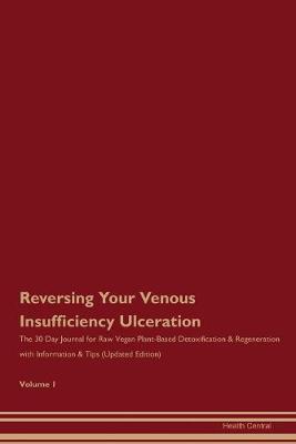 Book cover for Reversing Your Venous Insufficiency Ulceration