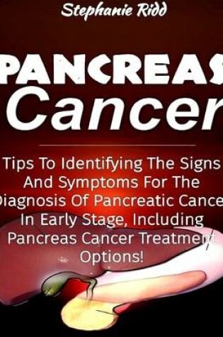 Cover of Pancreas Cancer: Tips to Identifying the Signs and Symptoms to Diagnosis Pancreatic Cancer At Early Stages, Including Pancreas Cancer Treatment Options!